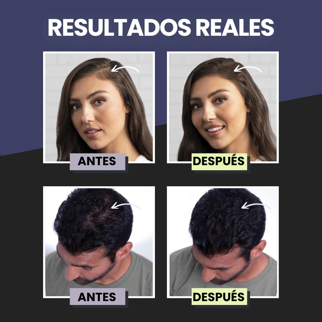 TOPPIK - Recupera la densidad de tu cabello