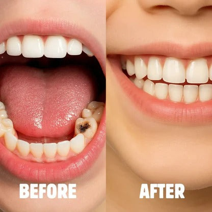 Cepillo Electrico Niños +Espuma dientes