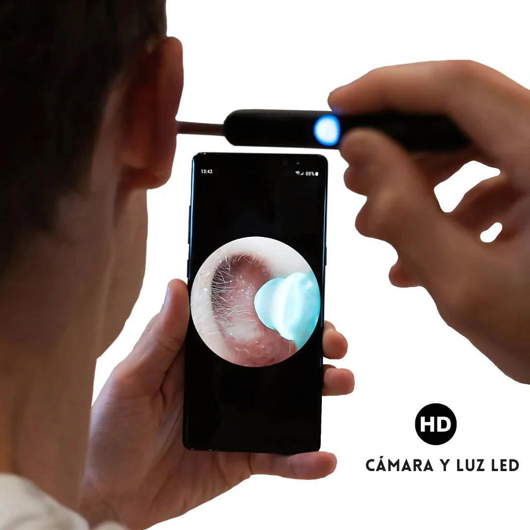 WaxClean: Limpiador De Oídos Inteligente Con Cámara