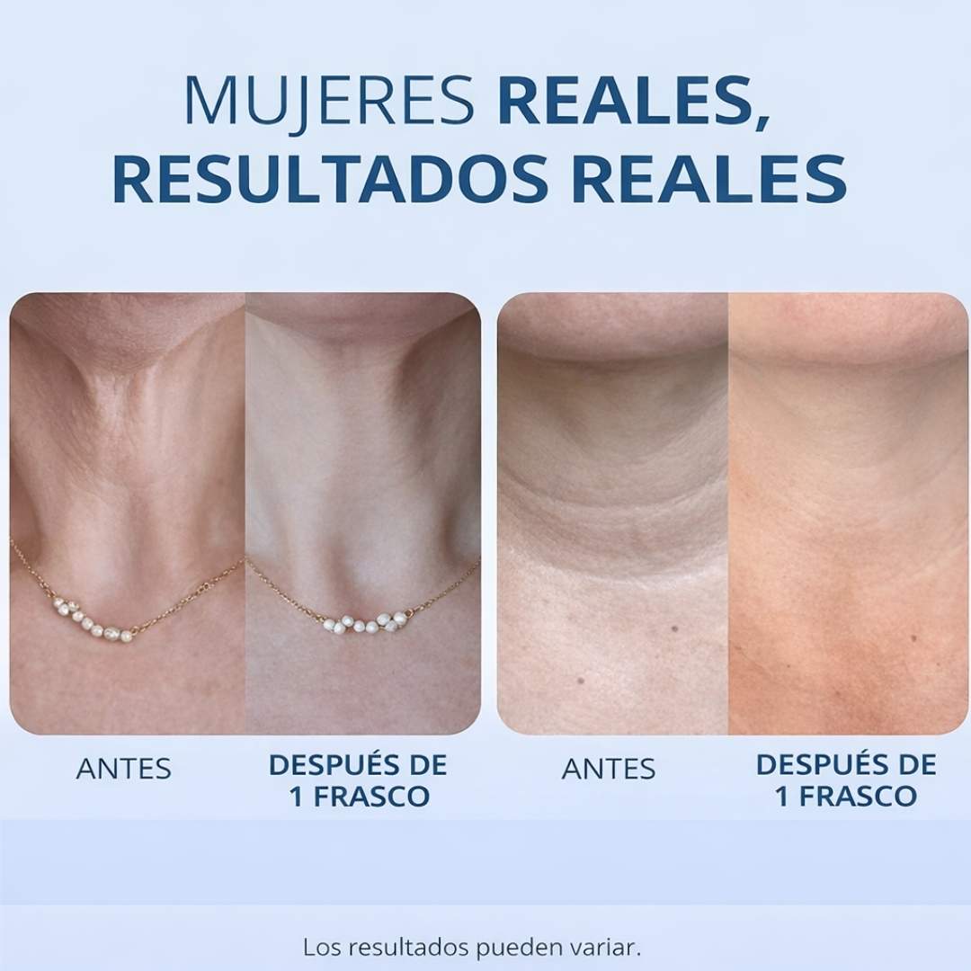 Crema GOPURE – Mejora la Apariencia de Firmeza Día a Día