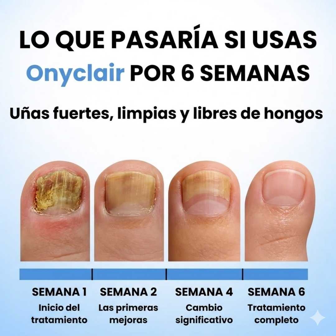 PARCHES ANTIHONGOS PARA UÑAS- SIENTE CONFIANZA TOTAL