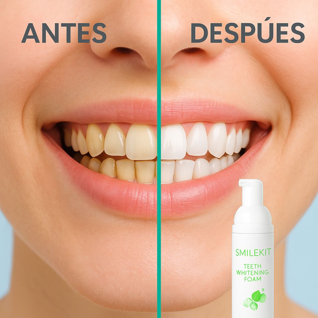 SmileKit® – Espuma Blanqueadora Dental con sabor a menta